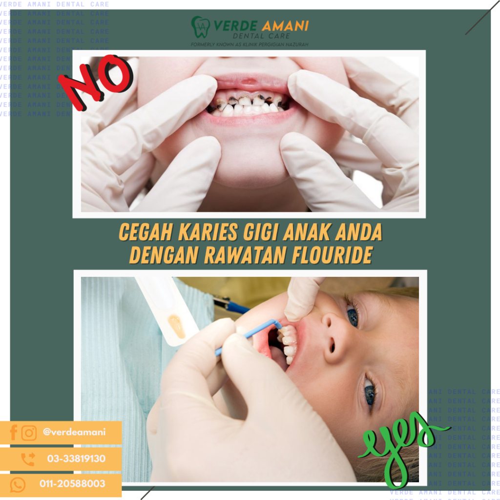 harga cabut gigi di klinik swasta