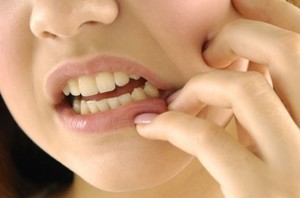 harga cabut gigi di klinik swasta